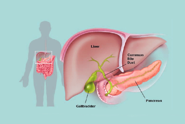 Gall bladder cancer surgery