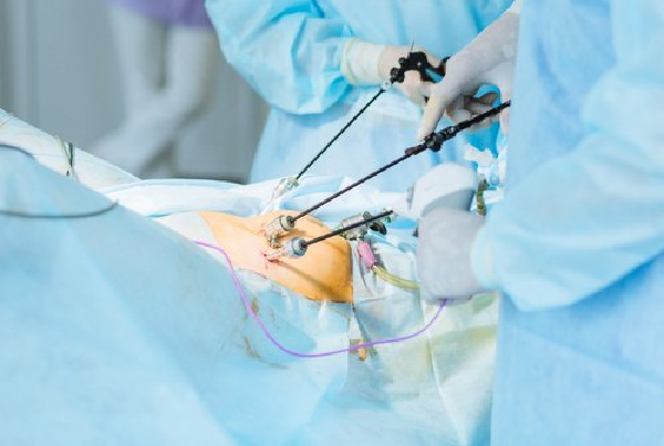 Laparoscopic Cancer Surgery