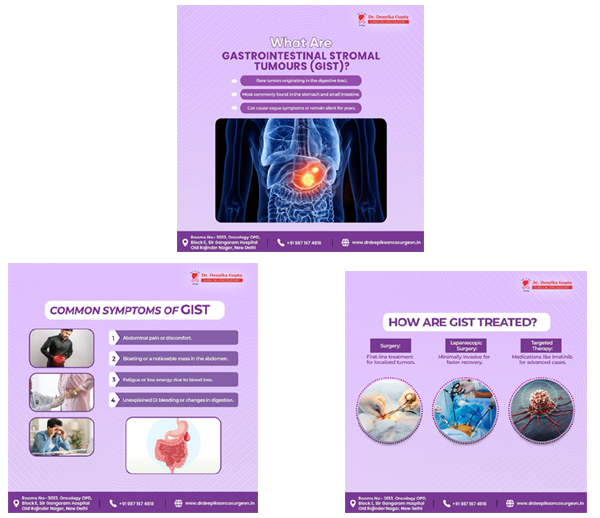 Gastrointestinal Stromal Tumours Surgery